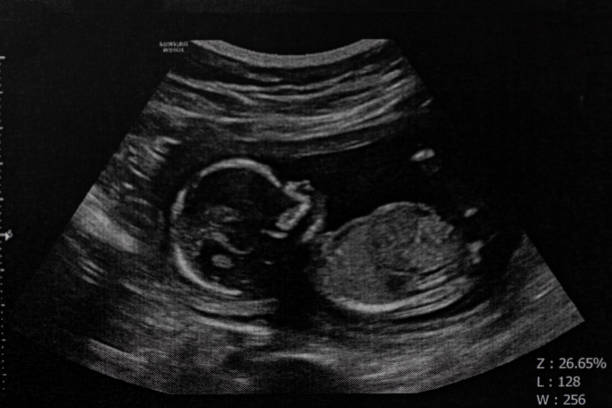 Show the planet your joy with the help of a fake pregnancy ultrasound post thumbnail image